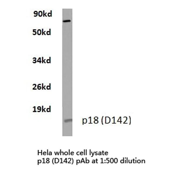 CDKN2C / p18 INK4c Antibody - Western blot of p18 INK (D142) pAb in extracts from HeLa cells.