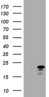 CDKN2C / p18 INK4c Antibody - HEK293T cells were transfected with the pCMV6-ENTRY control (Left lane) or pCMV6-ENTRY CDKN2C (Right lane) cDNA for 48 hrs and lysed. Equivalent amounts of cell lysates (5 ug per lane) were separated by SDS-PAGE and immunoblotted with anti-CDKN2C.