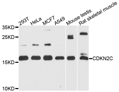 CDKN2C / p18 INK4c Antibody - Western blot analysis of extracts of various cell lines.