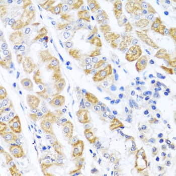 CDKN2C / p18 INK4c Antibody - Immunohistochemistry of paraffin-embedded human stomach tissue.