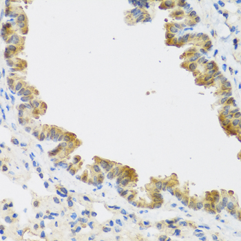 CDKN2C / p18 INK4c Antibody - Immunohistochemistry of paraffin-embedded mouse lung tissue.