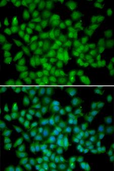 CDKN2C / p18 INK4c Antibody - Immunofluorescence analysis of HeLa cells.