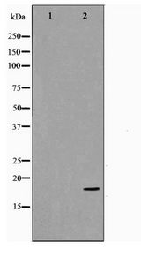 CDKN2C / p18 INK4c Antibody - Western blot of COS7 cell lysate using p18 INK Antibody