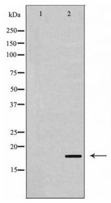 CDKN2C / p18 INK4c Antibody - Western blot of p18 INK expression in Cos7 cell extract