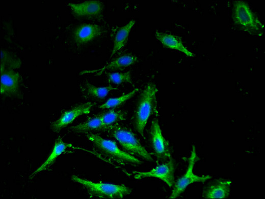 CDKN2C / p18 INK4c Antibody - Immunofluorescent analysis of Hela cells using CDKN2C Antibody at a dilution of 1:100 and Alexa Fluor 488-congugated AffiniPure Goat Anti-Rabbit IgG(H+L)