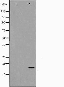 CDKN2C / p18 INK4c Antibody - Western blot analysis on COS7 cell lysates using p18 INK antibody. The lane on the left is treated with the antigen-specific peptide.