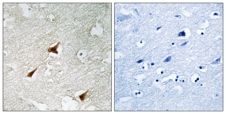 CDKN2D / p19 INK4d Antibody - Immunohistochemistry analysis of paraffin-embedded human brain, using p19 INK4d Antibody. The picture on the right is blocked with the synthesized peptide.