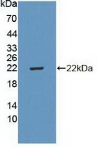 CDKN2D / p19 INK4d Antibody - Western Blot; Sample: Recombinant CDKN2D, Human.