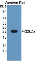 CDKN2D / p19 INK4d Antibody - Western Blot; Sample: Recombinant protein.