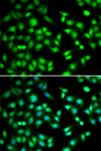 CDKN2D / p19 INK4d Antibody - Immunofluorescence analysis of HeLa cells.