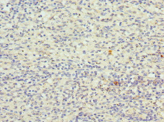 CDKN2D / p19 INK4d Antibody - Immunohistochemistry of paraffin-embedded human spleen tissue at dilution 1:100