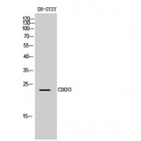 CDKN3 / KAP Antibody - Western blot of CDKN3 antibody