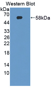 CDKN3 / KAP Antibody - Western blot of CDKN3 / KAP antibody.