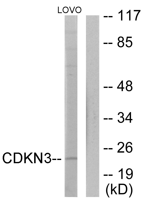 CDKN3 / KAP Antibody - Western blot analysis of lysates from LOVO cells, using CDKN3 Antibody. The lane on the right is blocked with the synthesized peptide.