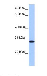 CDKN3 / KAP Antibody - Fetal lung lysate. Antibody concentration: 1.0 ug/ml. Gel concentration: 12%.  This image was taken for the unconjugated form of this product. Other forms have not been tested.