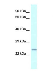 CDKN3 / KAP Antibody - Anti-CDKN3 antibody western blot of Mouse Heart lysate. Antibody concentration 1 ug/ml.  This image was taken for the unconjugated form of this product. Other forms have not been tested.
