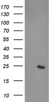 CDKN3 / KAP Antibody - HEK293T cells were transfected with the pCMV6-ENTRY control (Left lane) or pCMV6-ENTRY CDKN3 (Right lane) cDNA for 48 hrs and lysed. Equivalent amounts of cell lysates (5 ug per lane) were separated by SDS-PAGE and immunoblotted with anti-CDKN3.