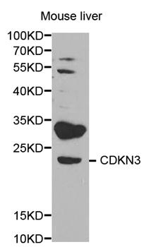 CDKN3 / KAP Antibody - Western blot analysis of extracts of mouse liver.