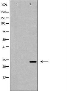 CDKN3 / KAP Antibody - Western blot analysis of extracts of mouse heart tissue using CDKN3 antibody. The lane on the left is treated with the antigen-specific peptide.