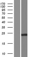 CDKN3 / KAP Protein - Western validation with an anti-DDK antibody * L: Control HEK293 lysate R: Over-expression lysate