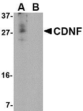 CDNF / ARMETL1 Antibody - Western blot of CDNF in A-20 cell lysate in (A) the absence and (B) the presence of blocking peptide with CDNF antibody at 1 ug/ml.