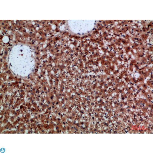 CDNF / ARMETL1 Antibody - Immunohistochemical analysis of paraffin-embedded human-liver, antibody was diluted at 1:200.