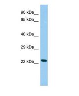 CDO1 / Cysteine Dioxygenase Antibody - Western blot of Cdo1 Antibody - C-terminal region in Rat Testis cells lysate.  This image was taken for the unconjugated form of this product. Other forms have not been tested.