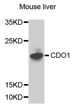 CDO1 / Cysteine Dioxygenase Antibody - Western blot analysis of extracts of mouse liver cells.