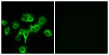 CDON / Cdo Antibody - Immunofluorescence analysis of HeLa cells, using CDON Antibody. The picture on the right is blocked with the synthesized peptide.
