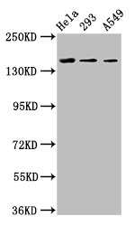 CDON / Cdo Antibody - Positive Western Blot detected in Hela whole cell lysate, 293 whole cell lysate, A549 whole cell lysate. All lanes: CDON antibody at 3.4 µg/ml Secondary Goat polyclonal to rabbit IgG at 1/50000 dilution. Predicted band size: 140, 137 KDa. Observed band size: 140 KDa