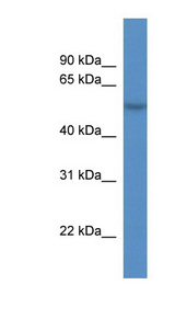 CDR2L Antibody - CDR2L antibody Western blot of OVCAR-3 cell lysate. This image was taken for the unconjugated form of this product. Other forms have not been tested.
