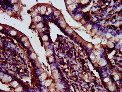CDR2L Antibody - Immunohistochemistry image at a dilution of 1:200 and staining in paraffin-embedded human small intestine tissue performed on a Leica BondTM system. After dewaxing and hydration, antigen retrieval was mediated by high pressure in a citrate buffer (pH 6.0) . Section was blocked with 10% normal goat serum 30min at RT. Then primary antibody (1% BSA) was incubated at 4 °C overnight. The primary is detected by a biotinylated secondary antibody and visualized using an HRP conjugated SP system.