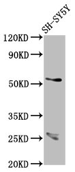 CDR2L Antibody - Positive Western Blot detected in SH-SY5Y whole cell lysate. All lanes: CDR2L antibody at 7.1 µg/ml Secondary Goat polyclonal to rabbit IgG at 1/50000 dilution. Predicted band size: 54 KDa. Observed band size: 54 KDa