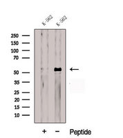 CDR2L Antibody - Western blot analysis of extracts of K562 cells using CDR2L antibody. The lane on the left was treated with blocking peptide.