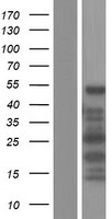 CDR2L Protein - Western validation with an anti-DDK antibody * L: Control HEK293 lysate R: Over-expression lysate