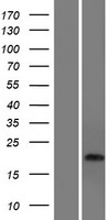 CDRT15 Protein - Western validation with an anti-DDK antibody * L: Control HEK293 lysate R: Over-expression lysate