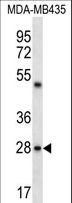 CDRT15L2 Antibody - CDRT15L2 Antibody western blot of MDA-MB435 cell line lysates (35 ug/lane). The CDRT15L2 antibody detected the CDRT15L2 protein (arrow).