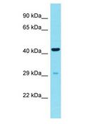 CDRT15L2 Antibody - CDRT15L2 antibody Western Blot of 293T. Antibody dilution: 1 ug/ml.  This image was taken for the unconjugated form of this product. Other forms have not been tested.