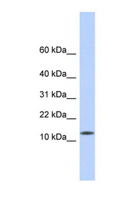 CDRT4 Antibody - CDRT4 antibody Western blot of Fetal Heart lysate. This image was taken for the unconjugated form of this product. Other forms have not been tested.