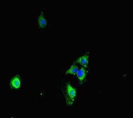 CDS1 Antibody - Immunofluorescent analysis of HeLa cells diluted at 1:100 and Alexa Fluor 488-congugated AffiniPure Goat Anti-Rabbit IgG(H+L)