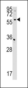 CDS2 Antibody - CDS2 Antibody western blot of HepG2 cell line lysates (35 ug/lane). The CDS2 antibody detected the CDS2 protein (arrow).