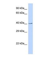 CDS2 Antibody - Western blot of Human 293T. CDS2 antibody dilution 1.0 ug/ml.  This image was taken for the unconjugated form of this product. Other forms have not been tested.