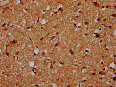 CDS2 Antibody - Immunohistochemistry Dilution at 1:200 and staining in paraffin-embedded human brain tissue performed on a Leica BondTM system. After dewaxing and hydration, antigen retrieval was mediated by high pressure in a citrate buffer (pH 6.0). Section was blocked with 10% normal Goat serum 30min at RT. Then primary antibody (1% BSA) was incubated at 4°C overnight. The primary is detected by a biotinylated Secondary antibody and visualized using an HRP conjugated SP system.