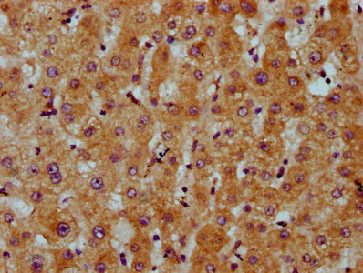 CDS2 Antibody - Immunohistochemistry Dilution at 1:200 and staining in paraffin-embedded human liver tissue performed on a Leica BondTM system. After dewaxing and hydration, antigen retrieval was mediated by high pressure in a citrate buffer (pH 6.0). Section was blocked with 10% normal Goat serum 30min at RT. Then primary antibody (1% BSA) was incubated at 4°C overnight. The primary is detected by a biotinylated Secondary antibody and visualized using an HRP conjugated SP system.