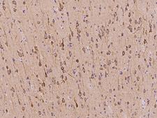 CDS2 Antibody - Immunochemical staining of human CDS2 in human brain with rabbit polyclonal antibody at 1:5000 dilution, formalin-fixed paraffin embedded sections.
