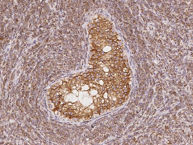 CDS2 Antibody - Immunochemical staining of human CDS2 in human testis with rabbit polyclonal antibody at 1:5000 dilution, formalin-fixed paraffin embedded sections.