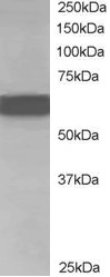 CDT1 Antibody - Antibody staining (1 ug/ml) of Human Brain lysate (RIPA buffer, 35 ug total protein per lane). Primary incubated for 1 hour. Detected by Western blot of chemiluminescence.