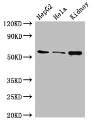 CDT1 Antibody - Positive WB detected in:HepG2 whole cell lysate,Hela whole cell lysate,Mouse kidney tissue;All lanes:CDT1 antibody at 3?g/ml;Secondary;Goat polyclonal to rabbit IgG at 1/50000 dilution;Predicted band size: 61 KDa;Observed band size: 61 KDa;