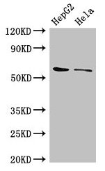 CDT1 Antibody - Western Blot Positive WB detected in: HepG2 whole cell lysate, Hela whole cell lysate All lanes: CDT1 antibody at 3µg/ml Secondary Goat polyclonal to rabbit IgG at 1/50000 dilution Predicted band size: 61 kDa Observed band size: 61 kDa