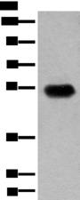 CDT1 Antibody - Western blot analysis of Human fetal brain tissue lysate  using CDT1 Polyclonal Antibody at dilution of 1:400